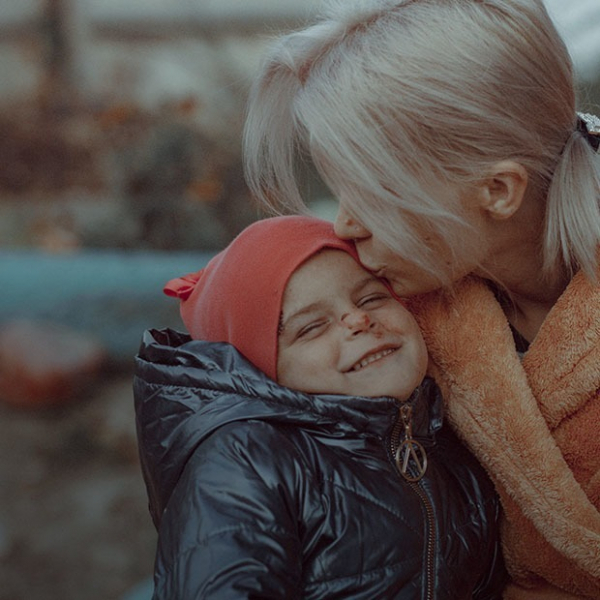 Моя дочь — бабочка: Как живет ребенок с буллезным эпидермолизом