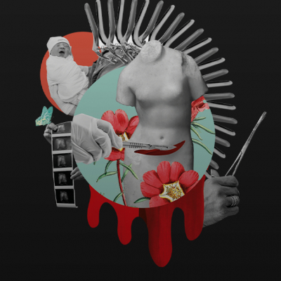 Лоботомия и электрический шок: Как раньше лечили шизофрению?